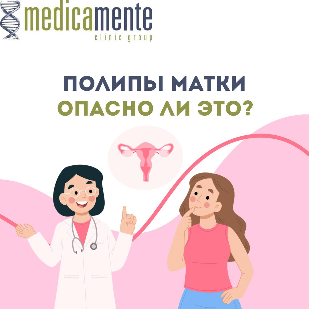 Полипы матки